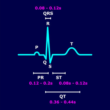 Normal ECG sinus rhythm with labeled P wave, QRS complex, T wave, PR interval, ST segment, and QT interval including standard duration values. Medical educational diagram of electrocardiogram. Vector.