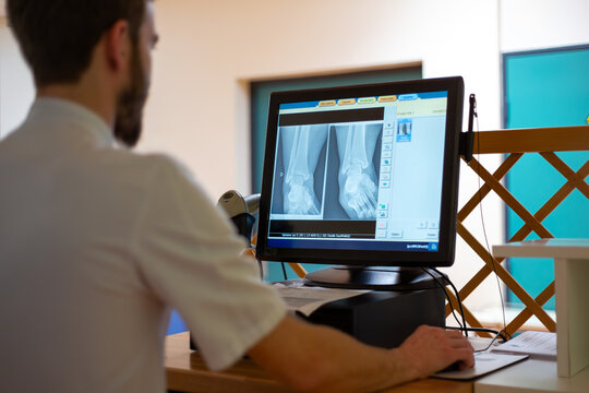 Service radiologie m&eacute;dical manipulateur controle radio cheville sur &eacute;cran ordinateur