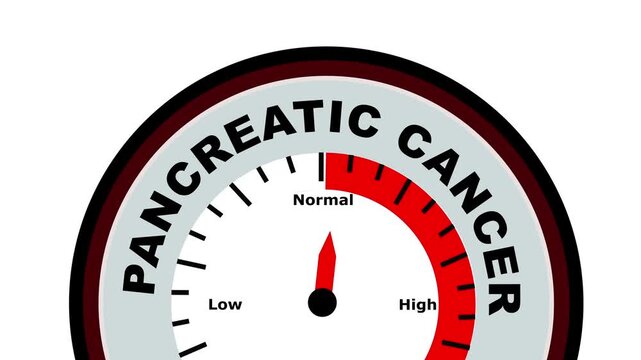 Pancreatic Cancer text or word shown with a barometer or tachometer-style gauge, representing varying levels of tumor progression and its impact on pancreatic function and overall health.