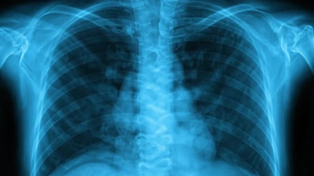 Medical x ray of human chest bones and internal organs in blue tones