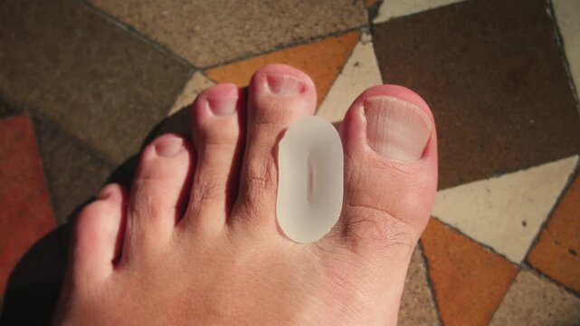Close-up of silicone toe separators, widely used in physiotherapy and podiatry as part of conservative treatment methods. High quality 4k footage