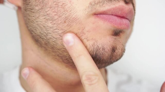 Young man applying beard growth oil with pipette close up