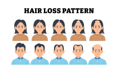 Fototapeta premium Stages of hair loss stages. Androgenetic alopecia male and female pattern character. Five stages of Baldness step. Balding process. Flat vector illustration.