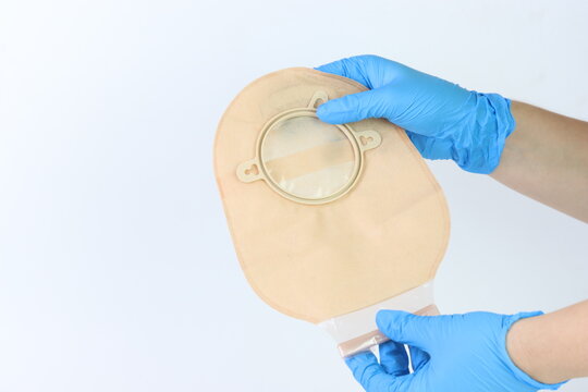 Healthcare professional demonstrates ostomy bag application with blue gloves against a white background