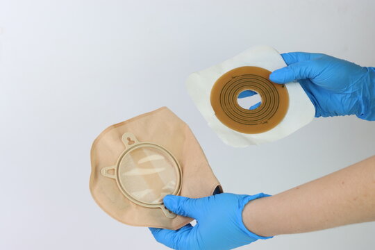 Healthcare professional demonstrates ostomy bag application with blue gloves against a white background