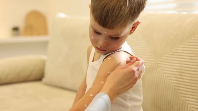 Mother applying cream onto skin of her son with chickenpox at home, closeup
