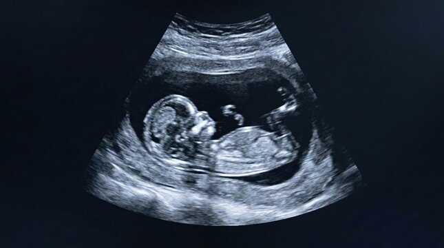 Ultrasound Image of Fetus in Womb Showing Developmental Stages