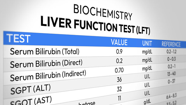 Liver Function Test Report. LFT, ALT AST Bilirubin Analysis, Enzyme Levels Assessment, Hepatic Health Screening, Diagnostic Evaluation and Clinical Monitoring Insights. Random LFT Test Report. 2D