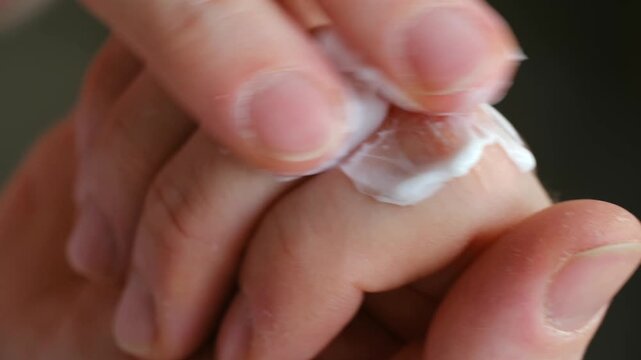 Close up person applying protective and moisturizing cream to their dry and chapped hands, gently massaging skin on knuckles for better absorption. Person applying moisturizing cream on dry hands