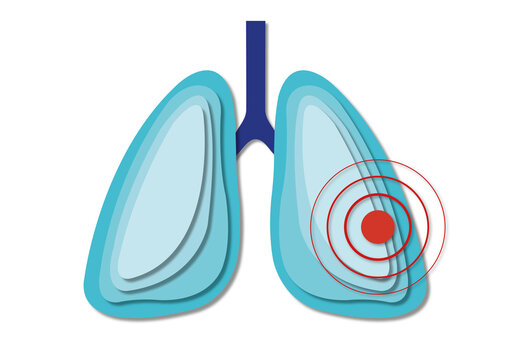 Lung pain, conceptual illustration