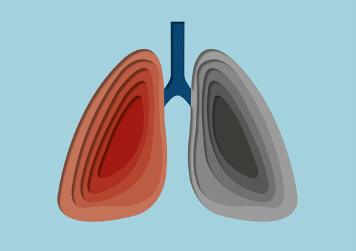 Tuberculosis, conceptual illustration