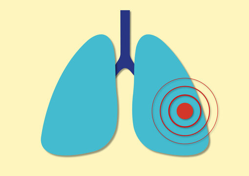Lung pain, conceptual illustration