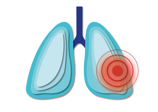 Lung pain, conceptual illustration