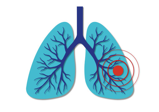 Lung pain, conceptual illustration