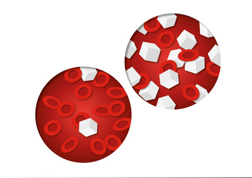 Hypoglycaemia and hyperglycaemia, conceptual illustration