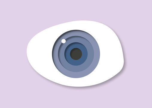 Misshapen eyeball, illustration