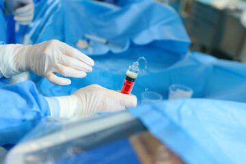 Obraz premium The work of the surgical team during laparoscopic surgery. Surgical interventions on blood vessels. Modern operating room. Vascular surgery.