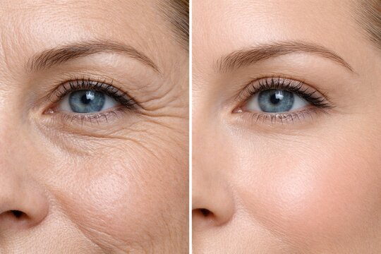Close-up comparison of aging and youthful eye skin texture effects. Ai generative