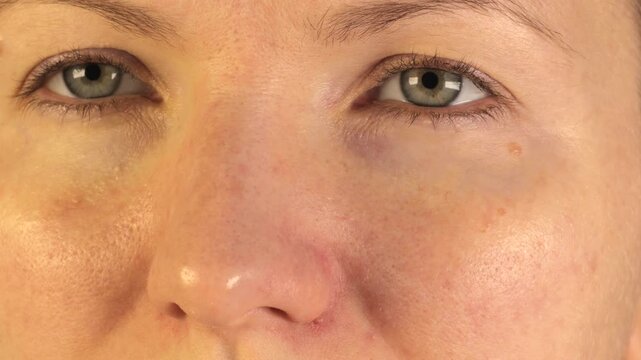 Woman apply gel under eye patches. Close up.