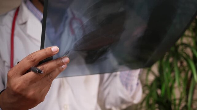 Close up video of doctor analyzing chest x-ray scan, health professional examining medical image in hospital