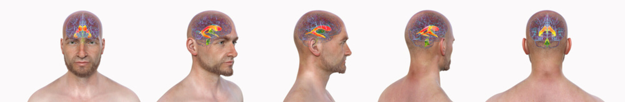 Lateral ventricles, 3D illustration