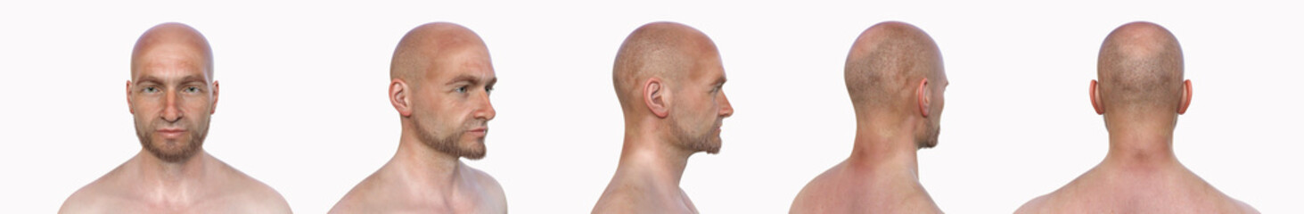 Obraz premium Third brain ventricle, 3D illustration