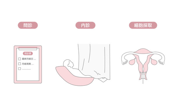 子宮頸がん検診の流れを説明する医療イラスト（問診・内診・細胞診）