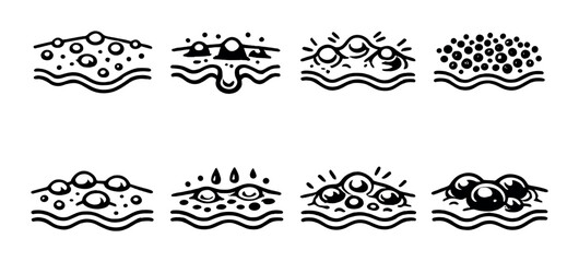 Skin pore and acne progression icons on gray background