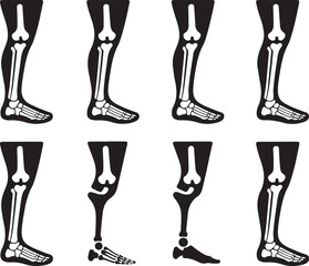 Human Leg Skeletal Anatomy Variations Illustration