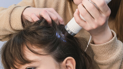 Fototapeta premium Trichologist examines hair and scalp of young woman in salon using trichoscope and dermatoscope. Woman's hair loss, dandruff and oily hair problems, scalp treatment and hair care consultations 