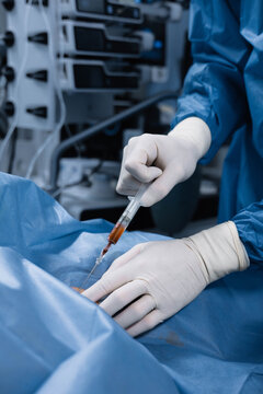Anesthesiologist placing intravenous catheter under sterile drapes in operating room before surgery process. Precision vascular access during perioperative anesthesia care. Medical intervention.