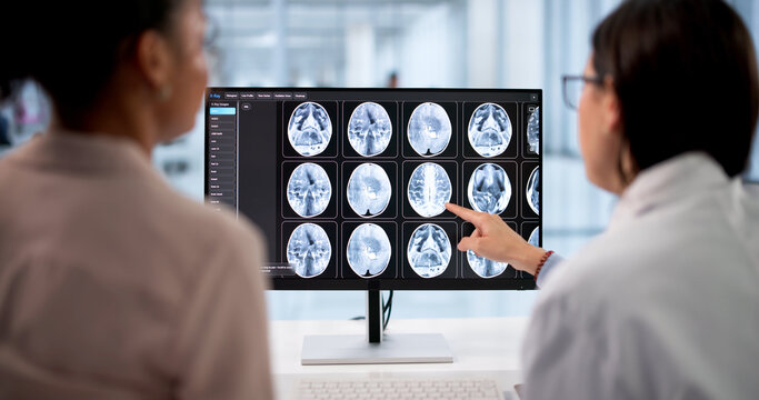 Expert Neurologist Giving Detailed Analysis Of MRI Brain Scan Image