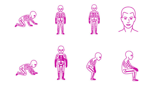 human skeletal development stages illustrating bone health growth and rickets progression medical science diagram.