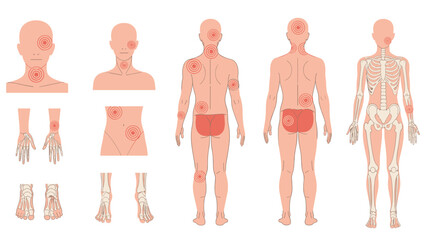 Comprehensive human body pain map illustrating areas of discomfort on various body parts and the skeletal system, useful for medical and health diagnoses.