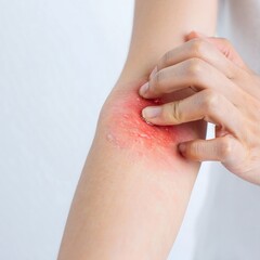 Close-up of irritated dry skin on arm, person scratching