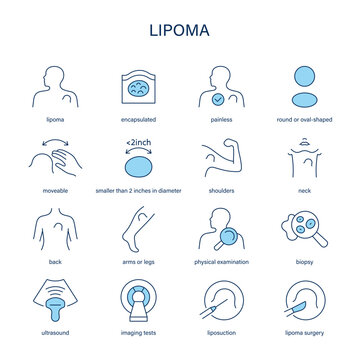Lipoma symptoms, diagnostic and treatment vector icon set