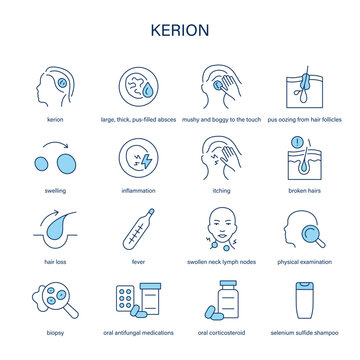Kerion symptoms, diagnostic and treatment vector icon set