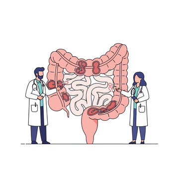 Doctors examine large intestine anatomy with diverticulitis and polyps, medical illustration