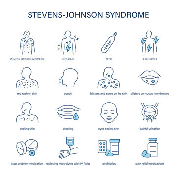 Stevens-Johnson Syndrome symptoms, diagnostic and treatment vector icon set