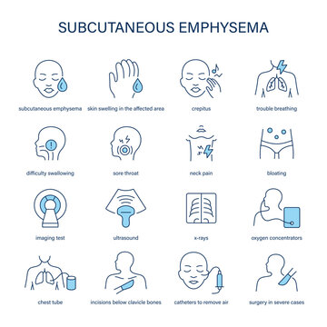 Subcutaneous Emphysema symptoms, diagnostic and treatment vector icon set