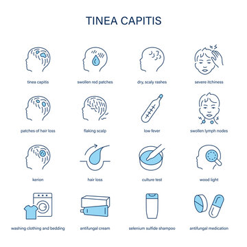 Tinea Capitis symptoms, diagnostic and treatment vector icon set