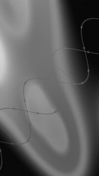 Medical X-ray of a ureteral stent in a patients urinary tract.