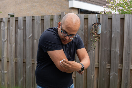 Man with diabetes, is changing his continuous blood sugar sensor.