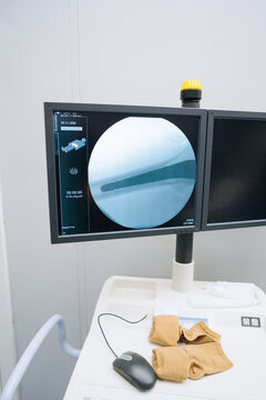 Working computer in the operating room