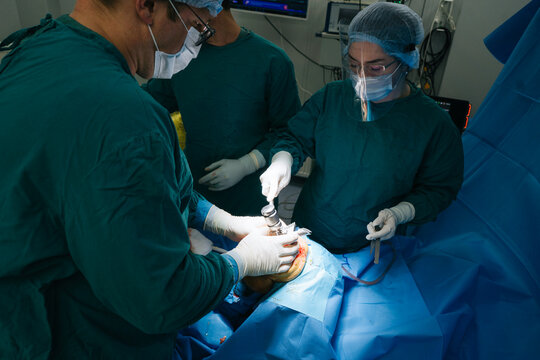 Closeup knee surgery