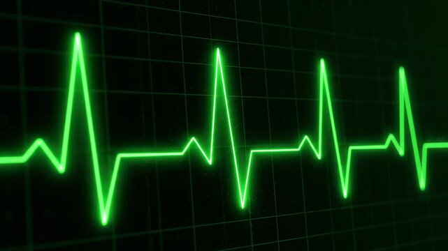 Green Heartbeat ECG Graphic on Dark Screen with Grid Lines