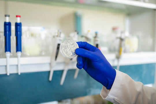 Bacterial culture in lab