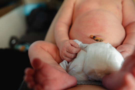 Newborn With Umbilical Stump
