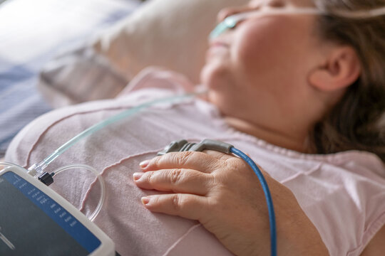 Patient undergoing clinical sleep study diagnostic sensors, woman sleeping with nasal cannula and pulse oximeter, medical monitoring apnea device, screening and treatment chronic sleep deprivation