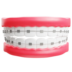 3d Illustration of Teeth Metal Braces Orthodontics Dental Icon